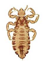 Sucking Lice Information & Facts for Kids